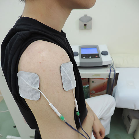 高電圧治療器　Hi-Voltage/マイクロカレント使用例肩