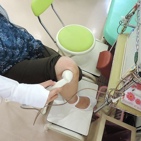 超音波治療器使用例